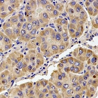 KIF1B antibody