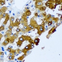 Anti-KIF3A Antibody