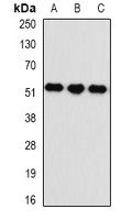 Kynureninase Rabbit Polyclonal Antibody