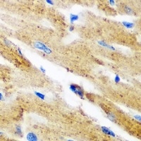 Anti-Kynureninase Antibody
