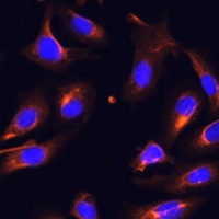 Anti-Melanophilin Antibody