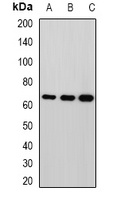 MPP2 Rabbit Polyclonal Antibody