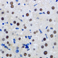 Anti-MTA3 Antibody