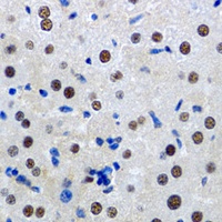 MTA3 antibody