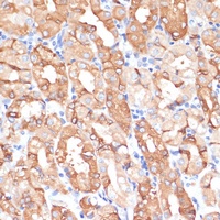 NHLRC1 antibody
