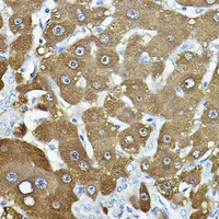 Anti-NNMT Antibody