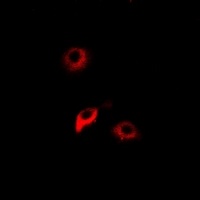 Anti-NNMT Antibody