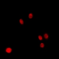 Anti-p47 Antibody