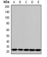 PCMT1 Rabbit Polyclonal Antibody