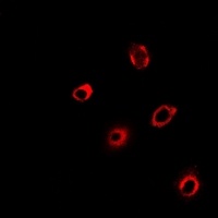 Anti-PCMT1 Antibody