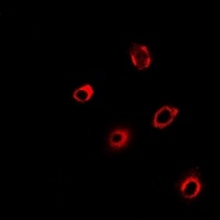 PCMT1 antibody