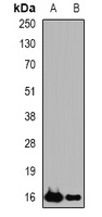 sPLA2-IID Rabbit Polyclonal Antibody