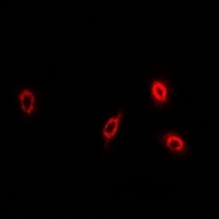 sPLA2-IID Rabbit Polyclonal Antibody