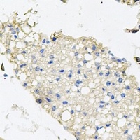 Anti-Atase Antibody