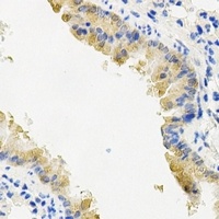 Anti-PYGL Antibody