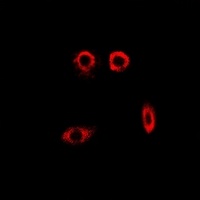 Anti-PYGL Antibody