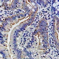 Anti-Ribophorin-1 Antibody