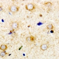 Anti-RPS14 Antibody