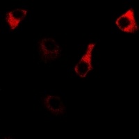 Anti-RPS14 Antibody