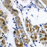 SerRS Antibody