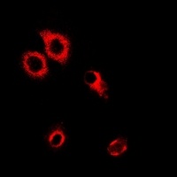 SerRS Antibody