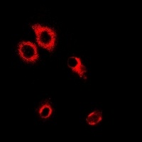 SARS antibody