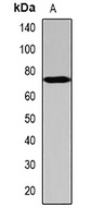 SCYL1 Rabbit Polyclonal Antibody