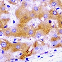 CCL13 antibody