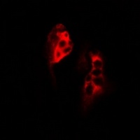 Anti-SCYL1 Antibody