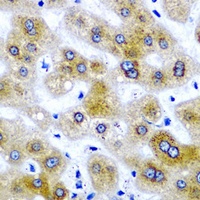 Anti-SBP-2 Antibody