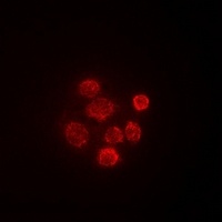 Anti-SBP-2 Antibody