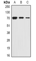 PiT2 Rabbit Polyclonal Antibody