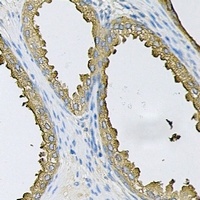 Anti-SRP19 Antibody