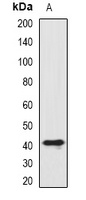 SIAT8D Rabbit Polyclonal Antibody