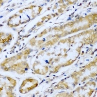 Anti-SUFU Antibody