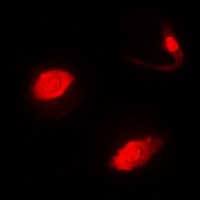 Anti-SUFU Antibody