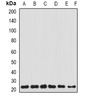 Transgelin-2 Rabbit Polyclonal Antibody