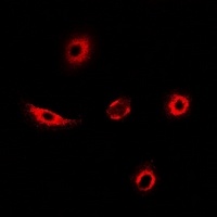 Anti-Transgelin-2 Antibody