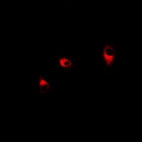 Anti-Transaldolase Antibody