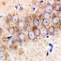 Anti-TMP21 Antibody
