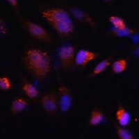 Anti-TMP21 Antibody