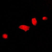 Anti-DCAF7 Antibody