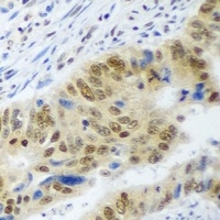 Anti-WDR48 Antibody