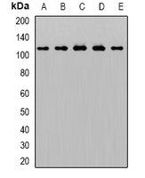 AP2-alpha-1 Rabbit Polyclonal Antibody