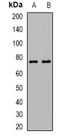 15-LO2 Rabbit Polyclonal Antibody