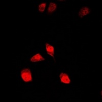 Anti-15-LO2 Antibody