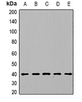 DGUOK Antibody