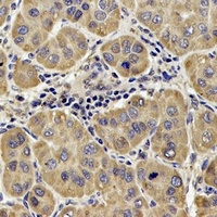 Anti-DLST Antibody