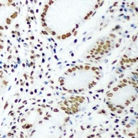 Anti-DR1 Antibody
