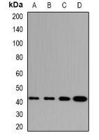 GABPB1 Rabbit Polyclonal Antibody